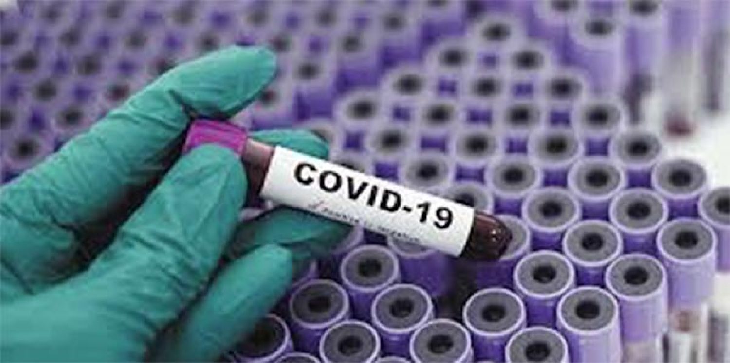 Σταματάει η αποστολή sms για τα rapid test