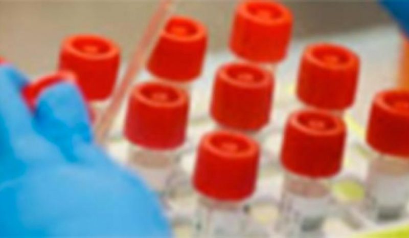Κάθε μέρα πραγματοποιούνται 13.000 στοχευμένα τεστ